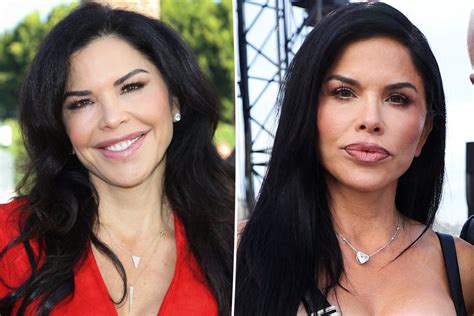 Lauren Sanchez Plastic Surgery: Before and After ...